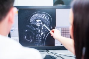 Risk Factors for Brain Injuries